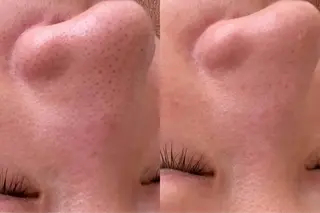 れふぇるん所属・れふぇるん 毛穴洗浄のエステ・リラクイメージ