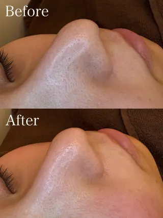 EARTH coiffure beaute 新潟紫竹山店所属・🤍アベシュリ /フェイシャル🤍のエステ・リラクイメージ