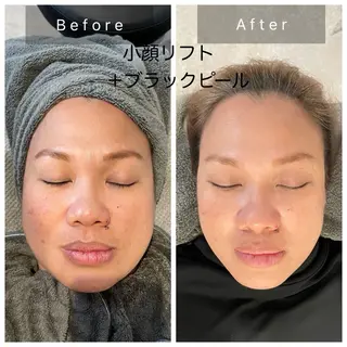 salon de perfectionのエステ・リラクイメージ