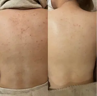 for woman所属・森 美優のエステ・リラクイメージ