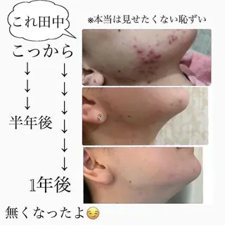 フェイシャル/脱毛 ジョアアンジェ　田中のエステ・リラクイメージ