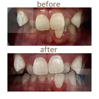 ホワイトニング ショップ船橋店のエステ・リラクイメージ