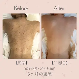 エステ＆美肌脱毛 ココサロ倉敷店のエステ・リラクイメージ