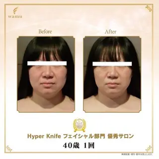 所沢痩身小顔コルギ AromaQueenのエステ・リラクイメージ