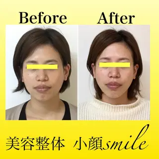 【小顔・姿勢矯正】 美容整体 SMILEのエステ・リラクイメージ