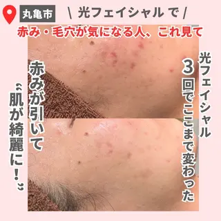 前山 くるみのエステ・リラクイメージ