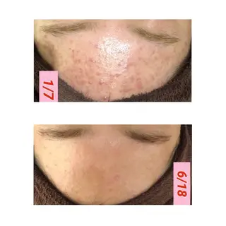 セミロング カラー パーマ ヘアアレンジ メンズ キッズ ネイル マツエク・マツパ 四つ星サロン🎖 腸＆ニキビケアに特化のエステ・リラクイメージ