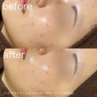 lulularico Yuのエステ・リラクイメージ