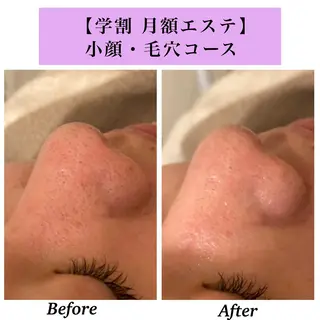 Bellesthe (ベルエステ)のエステ・リラクイメージ