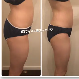 FLEUR大阪・美容 整体・痩身・小顔のエステ・リラクイメージ