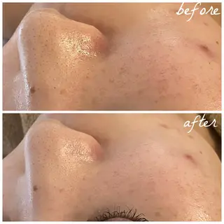 メンズ メナード岐阜茜部 杉浦のエステ・リラクイメージ