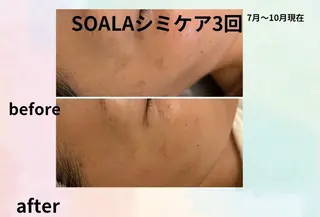 美容整体師  江上のエステ・リラクイメージ