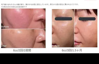 ナスサロ️ 看護師️🫧山口のエステ・リラクイメージ