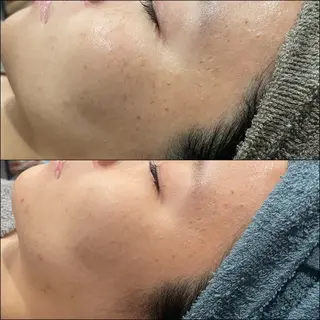 LiZA エステティックサロンのエステ・リラクイメージ