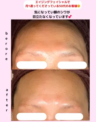 ベラージュ【美背中・ 美尻・フェイシャル】のエステ・リラクイメージ