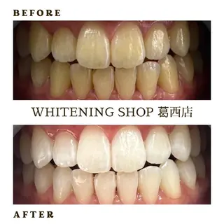 ホワイトニング ショップ葛西店のその他イメージ