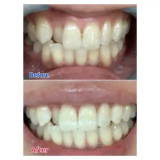 MBEAUTYSALON 千葉店・京成大久保所属・Melty 輝のその他イメージ