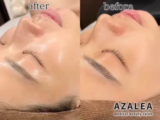 medical salon AZALEA 新宿店所属・牛込 桃香のエステ・リラクイメージ