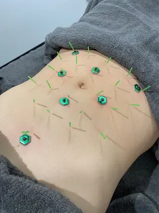 メディカルサロンドオフ所属・ハリサロンドオフ 美容鍼灸×小顔整体のエステ・リラクイメージ