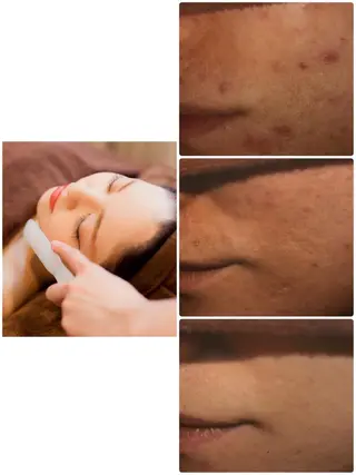 美肌脱毛専門サロン Dione栄店のエステ・リラクイメージ