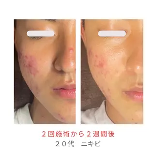 ベラージュ【美背中・ 美尻・フェイシャル】のエステ・リラクイメージ