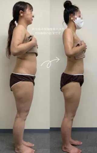 ビューティコア所属・【二子玉川】 ビューティコアのエステ・リラクイメージ