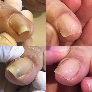 ネイル 東京巻き爪アカデミー所属・東京巻き爪 アカデミーのエステ・リラクイメージ