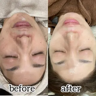 laluna saki...のその他イメージ