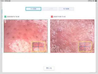 毛穴専門店Bébéもりの里店所属・毛穴専門店Bébé もりの里店のエステ・リラクイメージ