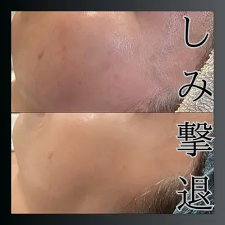 LiZA エステティックサロンのエステ・リラクイメージ