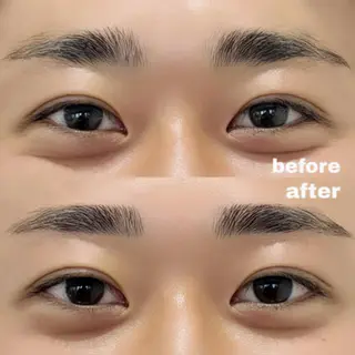 メンズ アイブロウ 🦋表参道/原宿 🦋Chibaの眉毛・アイブロウイメージ