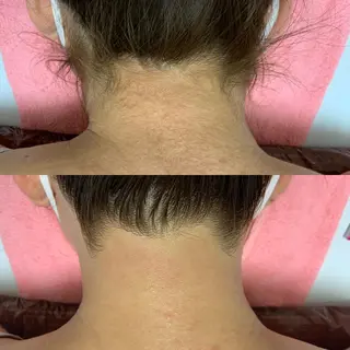 透明感の肌Lino malieのエステ・リラクイメージ