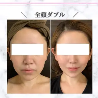 毛穴専門サロン ルシェリアのエステ・リラクイメージ