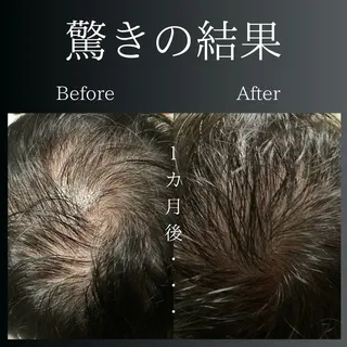 LiZA エステティックサロンのエステ・リラクイメージ