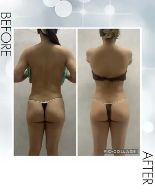 Eclat所属・痩身専門エステサロン Eclatのエステ・リラクイメージ