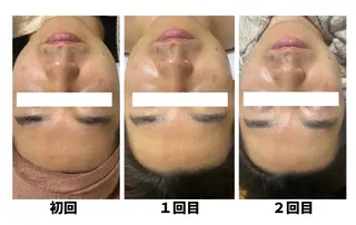 メンズ Linoa所属・Linoa（リノア） エステ&リラクのエステ・リラクイメージ