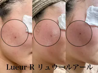 大久保 里奈のエステ・リラクイメージ