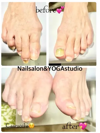 ネイル Tairacchi ﾀｲﾗｯﾁのエステ・リラクイメージ