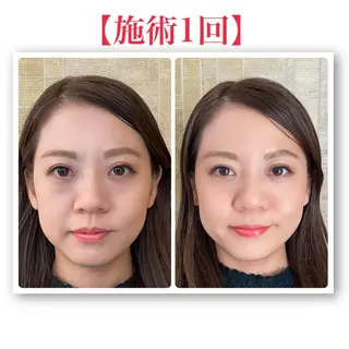 小顔トータルサロンUnica（ウニカ）所属・小顔トータルサロン Unicaのエステ・リラクイメージ