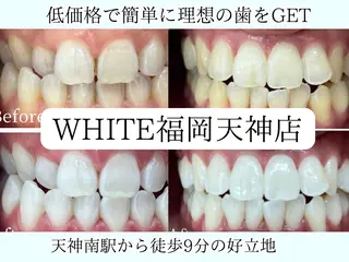 メンズ ホワイトニング専門店 WHITE天神店のエステ・リラクイメージ