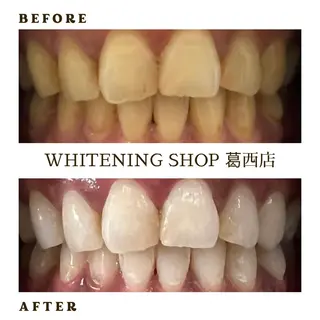 メンズ ホワイトニング ショップ葛西店のその他イメージ