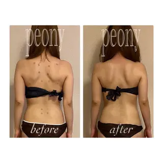 デトックス美容専門サロンpeony所属・デトックス美容専門 サロンpeonyのエステ・リラクイメージ