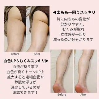 PRETTIEST SHINE所属・山田 浩子のエステ・リラクイメージ
