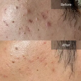 clé skin 🌿ハーブピーリングのエステ・リラクイメージ