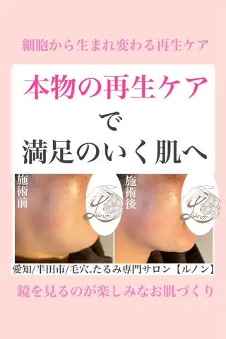 毛穴.たるみ専門店 Lunonのエステ・リラクイメージ