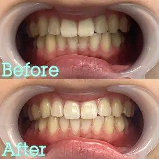 歯のホワイトニング専門店 MIGAQ 京都四条大宮店所属・佐藤 未来の眉毛・アイブロウイメージ