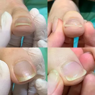 ネイル minion蕨所属・minion 蕨のネイルデザイン