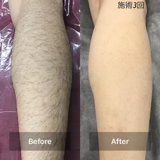 メンズ Mens Salon SOLEのエステ・リラクイメージ