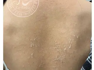 Belsia千歳烏山 ピーリング&眉毛のエステ・リラクイメージ