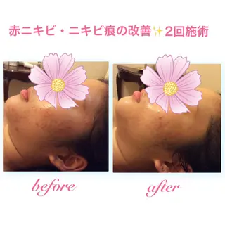 ダイエット・美肌ケア fleurのエステ・リラクイメージ